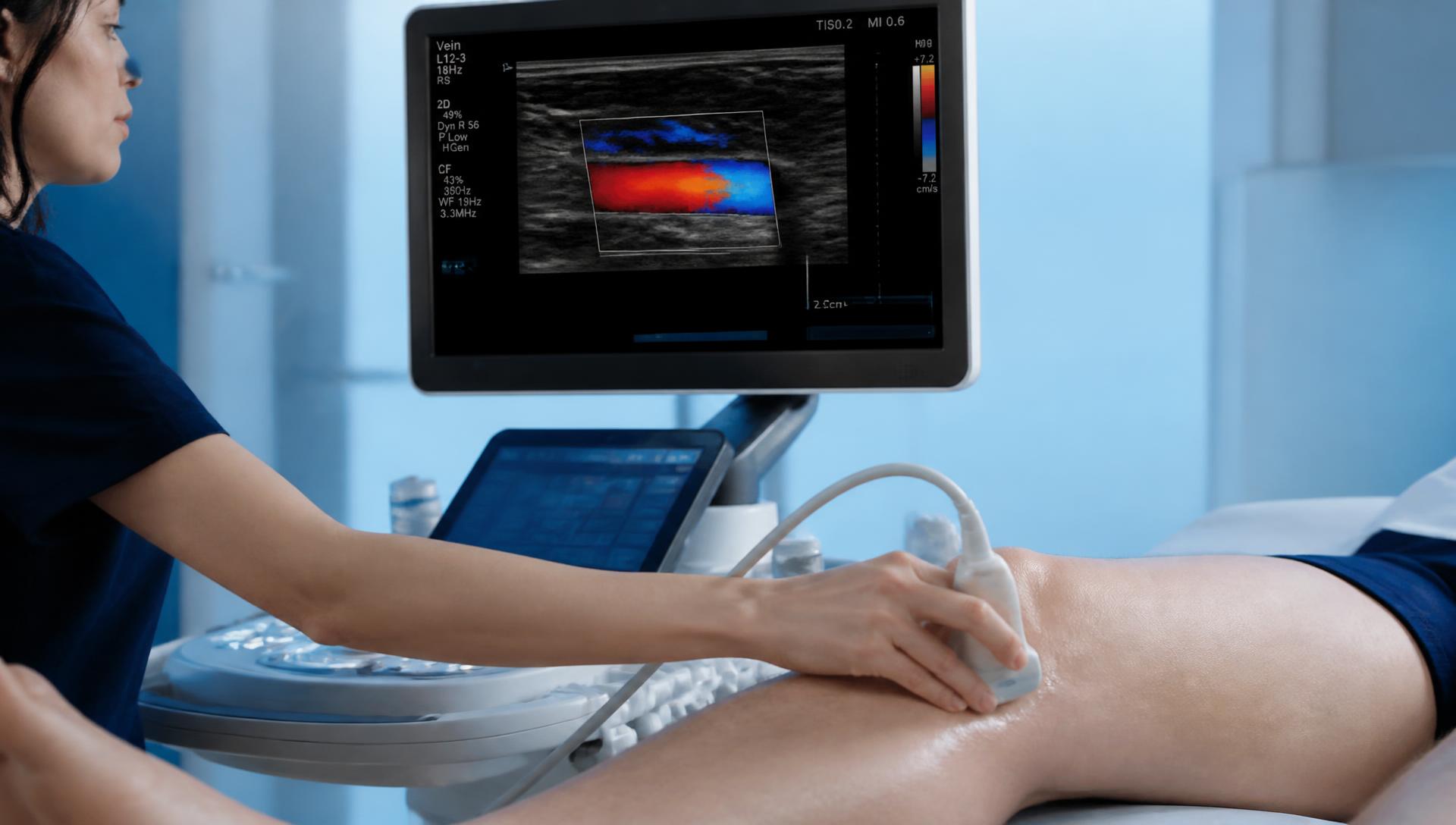 Exame de doppler vascular colorido em membro inferior